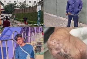 PT Tri Excella Harmony Diduga Mempermainkan Karyawan Korban Kecelakaan Kerja