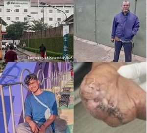 PT Tri Excella Harmony Diduga Mempermainkan Karyawan Korban Kecelakaan Kerja